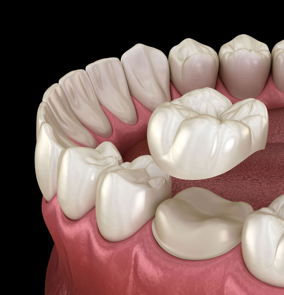 crown 3d model