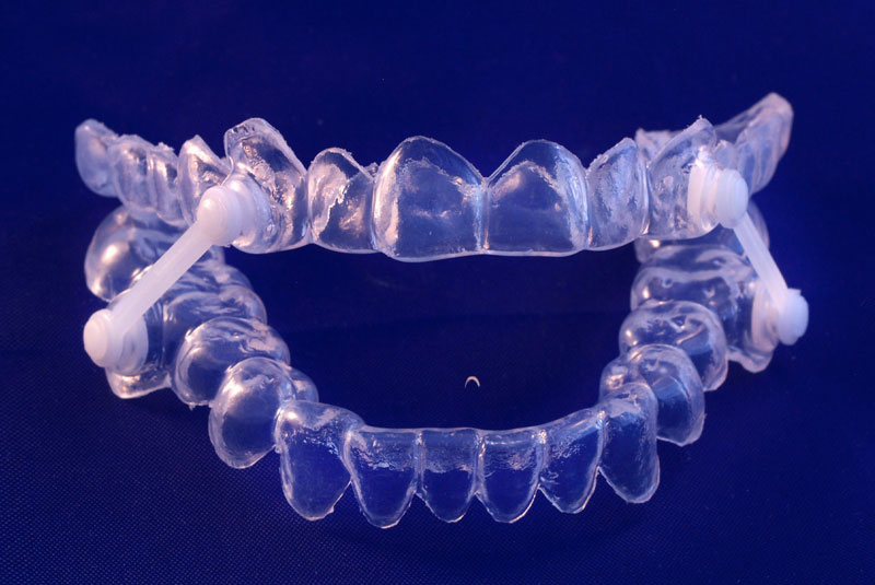 mouth guard used for sleepapnea other dental issues