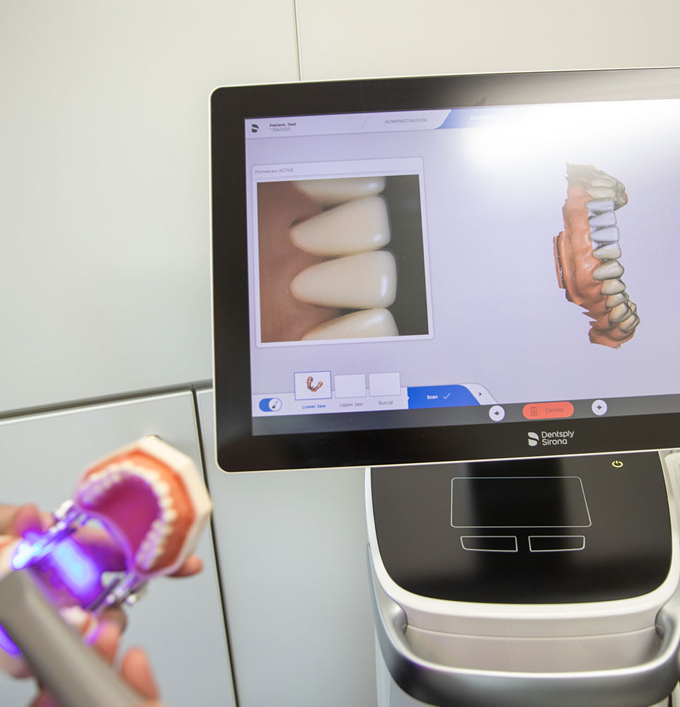 dental emergency scanning itero
